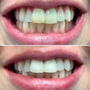 Teeth-Whitening-and-spa-The-Tanning-Lounge-2 Teeth-Whitening-and-spa-The-Tanning-Lounge-2